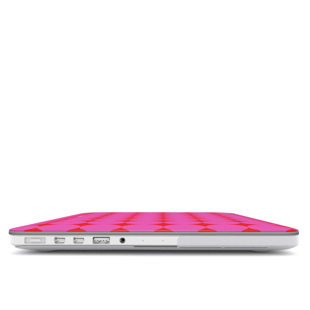 MacBook Case - Double Pink