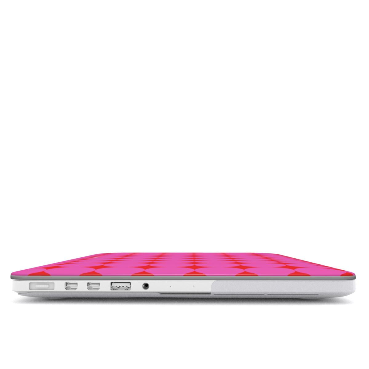 MacBook Case - Double Pink