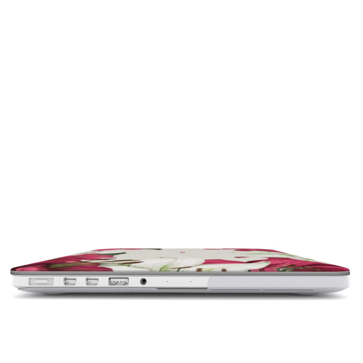 MacBook Case - Lillies