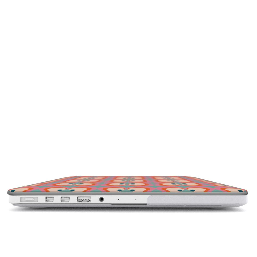 MacBook Case - Retro