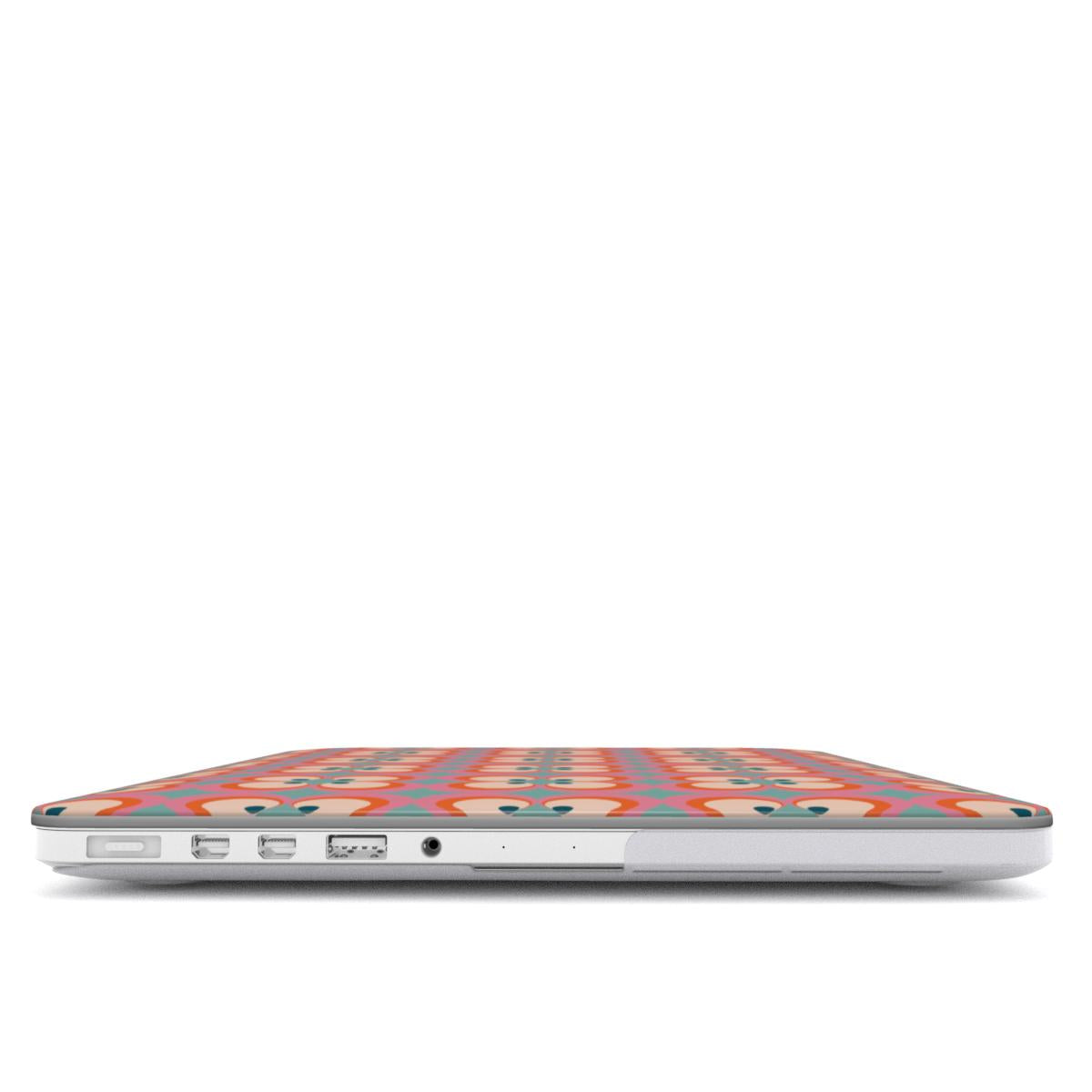 MacBook Case - Retro