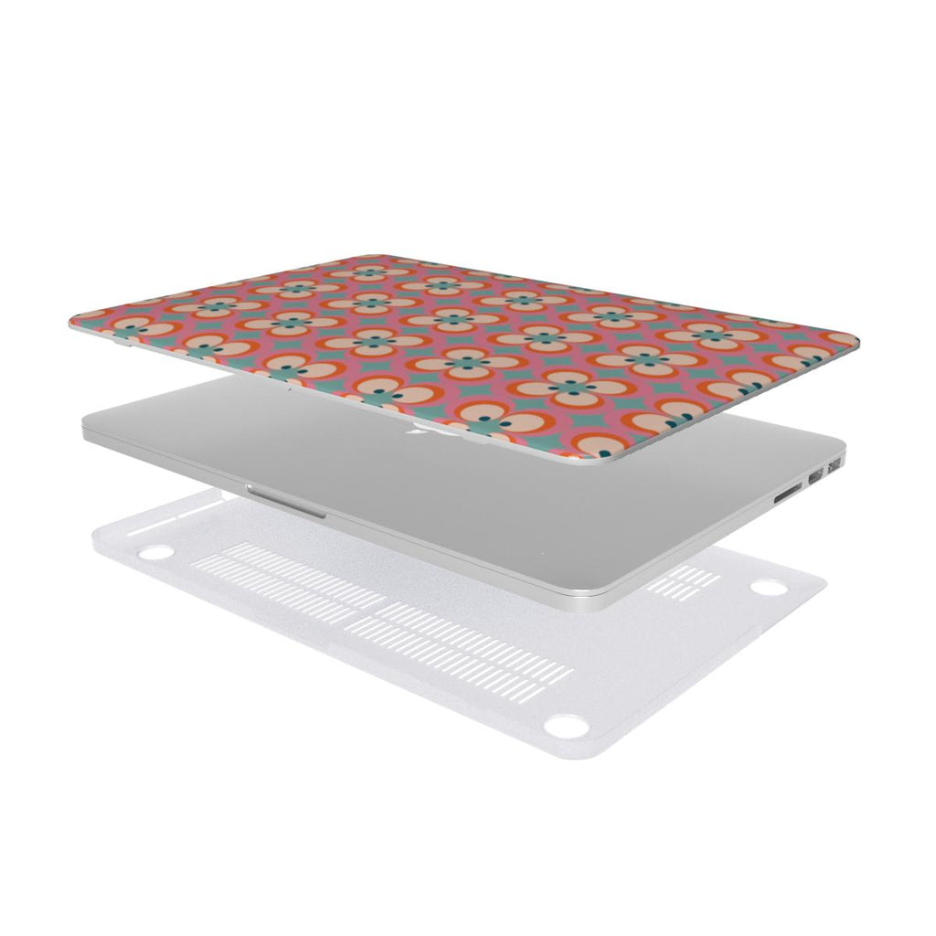 MacBook Case - Retro
