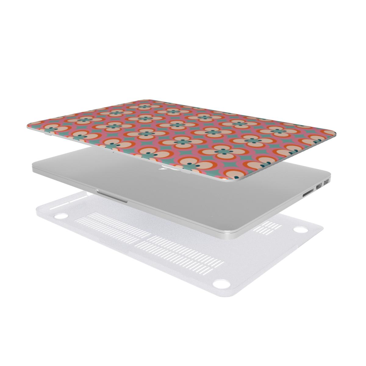 MacBook Case - Retro